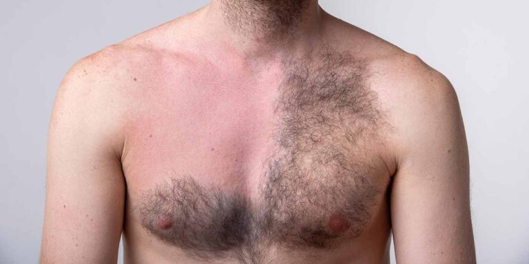 crème dépilatoire homme