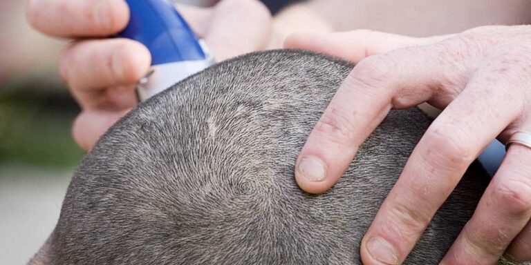 Raser son crâne à la tondeuse